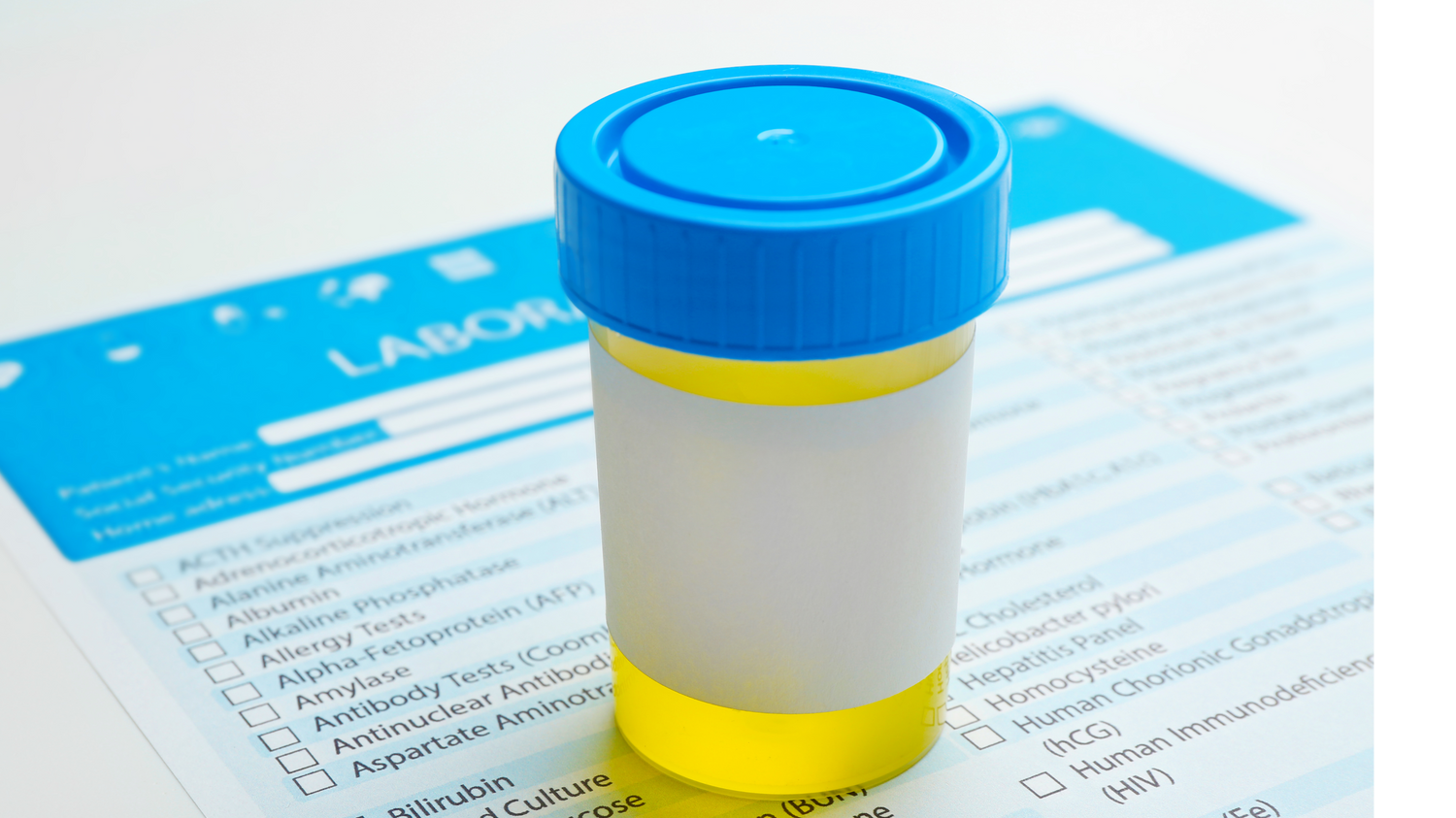 Urine specimen cup with blue lid placed on top of a laboratory testing document